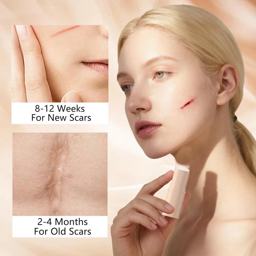 Silicon Scar Removal Stick (BUY 1 GET 1 FREE) - Image 3