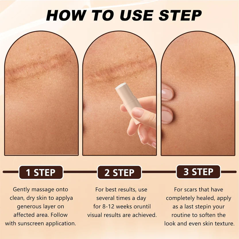 Silicon Scar Removal Stick (BUY 1 GET 1 FREE) - Image 5
