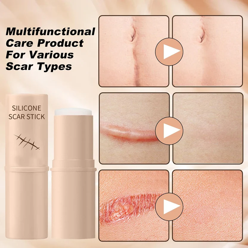 Silicon Scar Removal Stick (BUY 1 GET 1 FREE) - Image 6