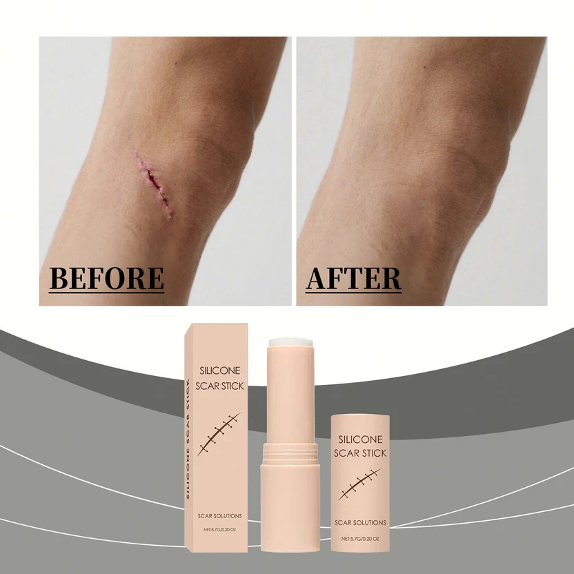 Silicon Scar Removal Stick (BUY 1 GET 1 FREE) - Image 7