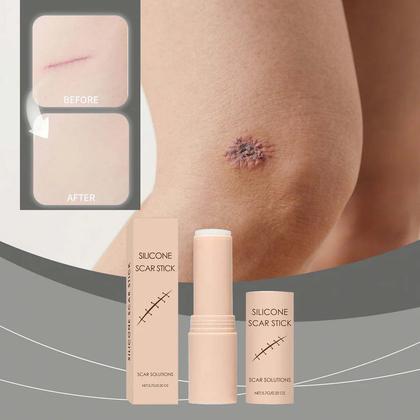 Silicon Scar Removal Stick (BUY 1 GET 1 FREE) - Image 8